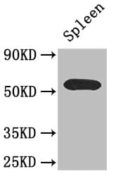 Polyclonal Rabbit anti-Human ZDHHC1 Antibody (IHC, IF, WB)