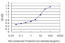 TNXB / Tenascin XB Antibody (clone 2D3-1B10)