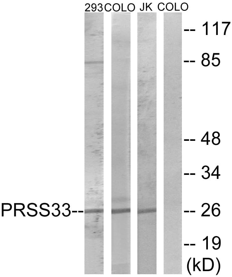 Polyclonal Rabbit anti-Human PRSS33 Antibody (aa18-67, WB)