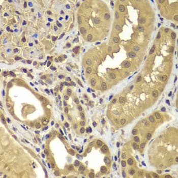 SORT1 / Sortilin Antibody