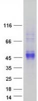 Human CCN4 / WISP1 Protein (Recombinant Myc-DDK (Flag))