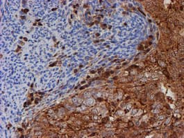 PSMB9 Antibody (clone OTI3H1)