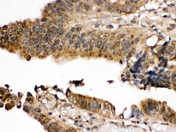 MAP2K7 / MEK7 Antibody
