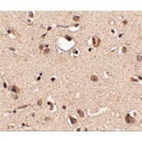 SLITRK3 Antibody