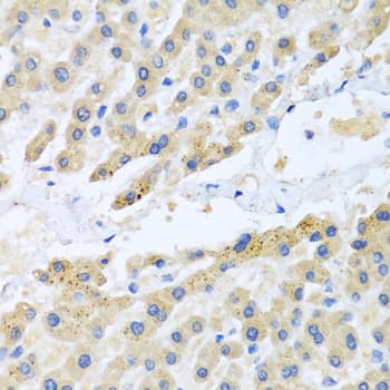 Polyclonal Rabbit anti-Human CCL3 / MIP-1-Alpha Antibody (IHC, WB)