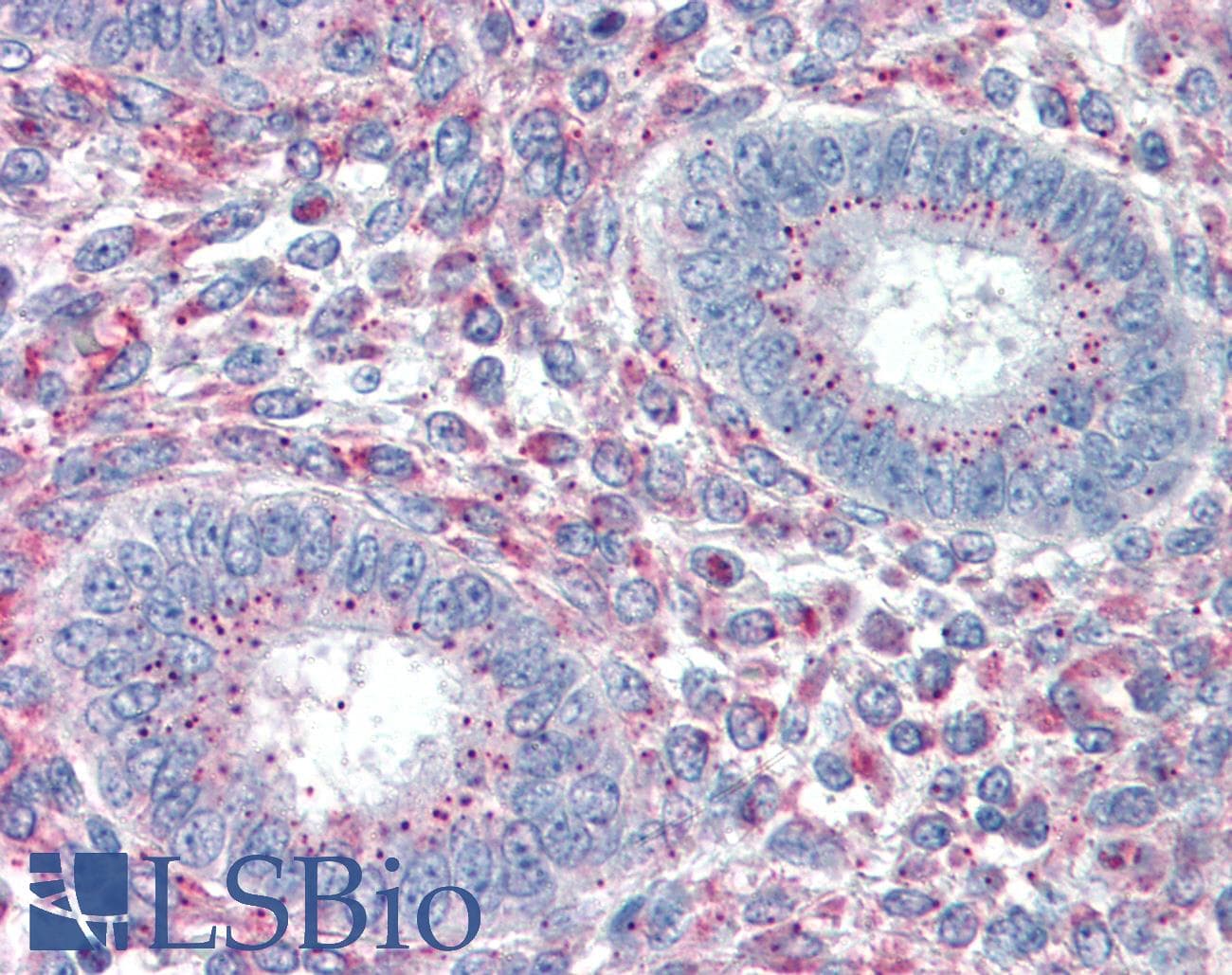 IHC-plus™ PRX-1 / PRRX1 Antibody (aa73-83)