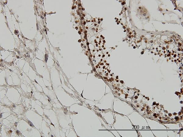 Monoclonal Mouse anti-Human TRIM33 / TIF1-Gamma Antibody (clone 6D1, IHC, IF, WB)