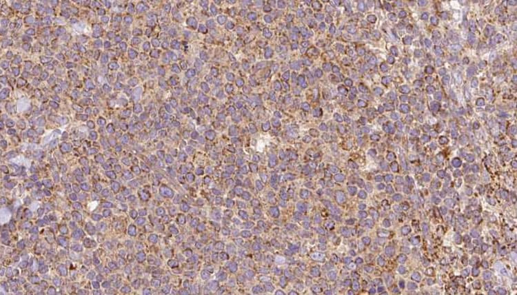 Polyclonal Rabbit anti-Human ATP6V1A1 / ATP6V1A Antibody (IHC, WB)