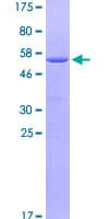 Human CCDC186 / C10orf118 Protein (Recombinant GST)