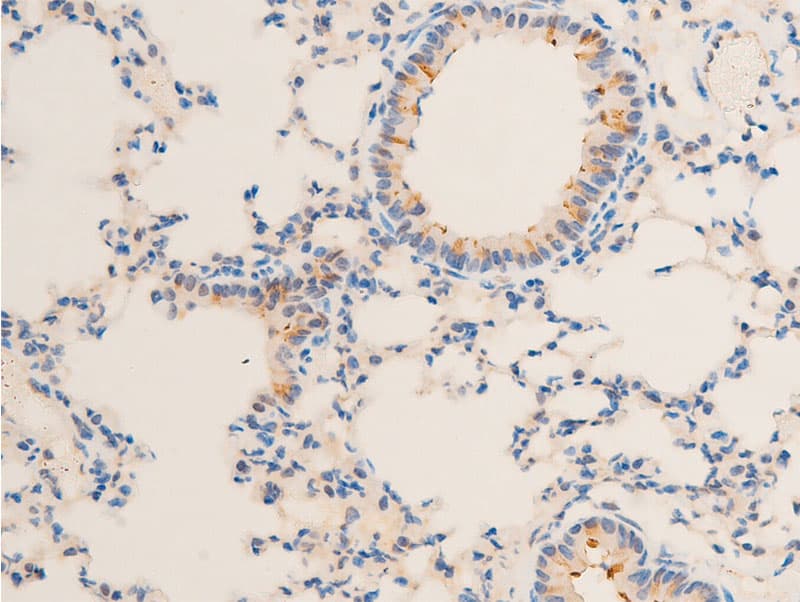 SGK1 / SGK Antibody (phospho-Ser422)