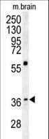 MAPRE1 / EB1 Antibody (aa44-71)
