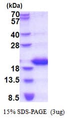 Human LCN1 / Lipocalin-1 Protein (Recombinant His)