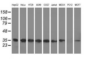 CYB5R3 / B5R Antibody (clone OTI2A10)