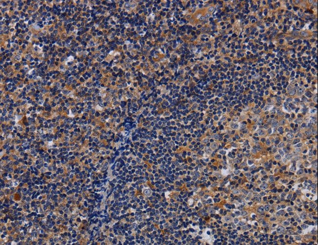 Polyclonal Rabbit anti-Human LIMS1 / PINCH Antibody (IHC, WB)