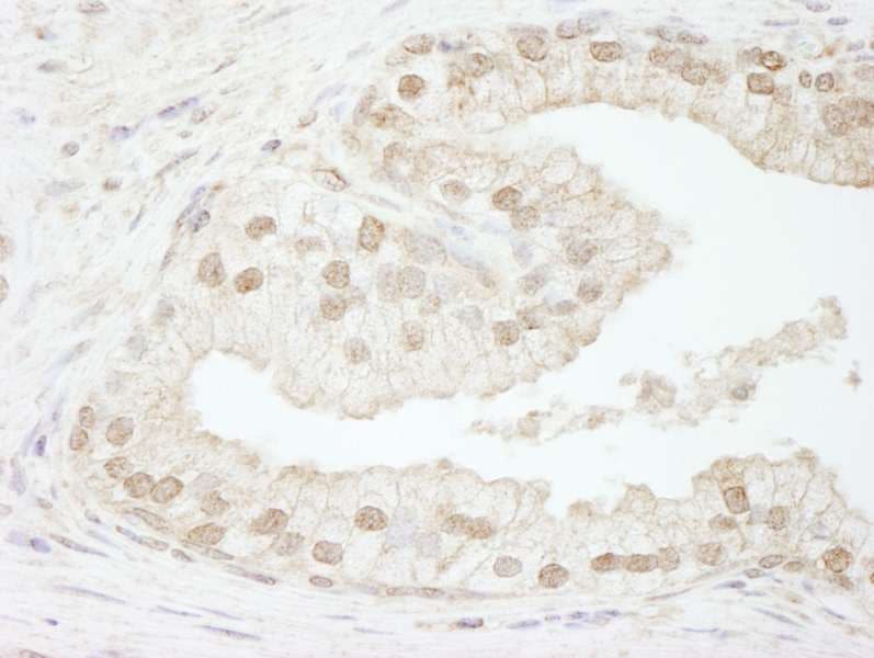 Polyclonal Rabbit anti-Human CHAF1B / CAF1 Antibody (aa509-C-term, IHC)
