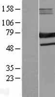 SAMHD1 Protein (Over-Expression Lysate Myc-DDK (Flag))