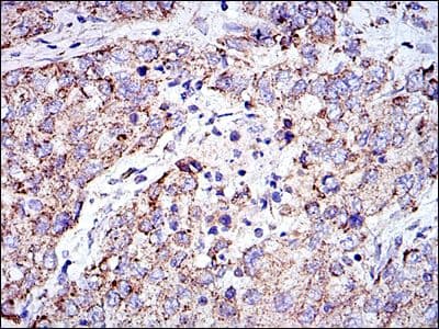 PHB / Prohibitin Antibody (clone 5H7)
