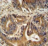 Polyclonal Rabbit anti-Human VPS52 / SACM2L Antibody (aa610-637, IHC, IF, WB)