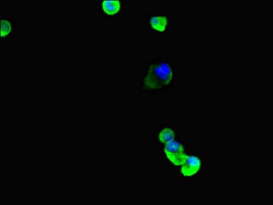 TUBB4 / Tubulin Beta 4 Antibody
