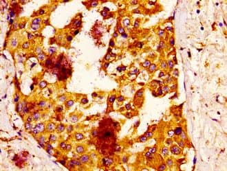 IQCB1 Antibody