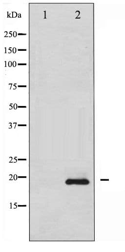 STMN1 / Stathmin / LAG Antibody (phospho-Ser15)