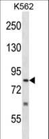 SENP5 Antibody (aa718-747)