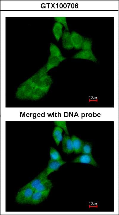 IHC-plus™ MMP3 Antibody