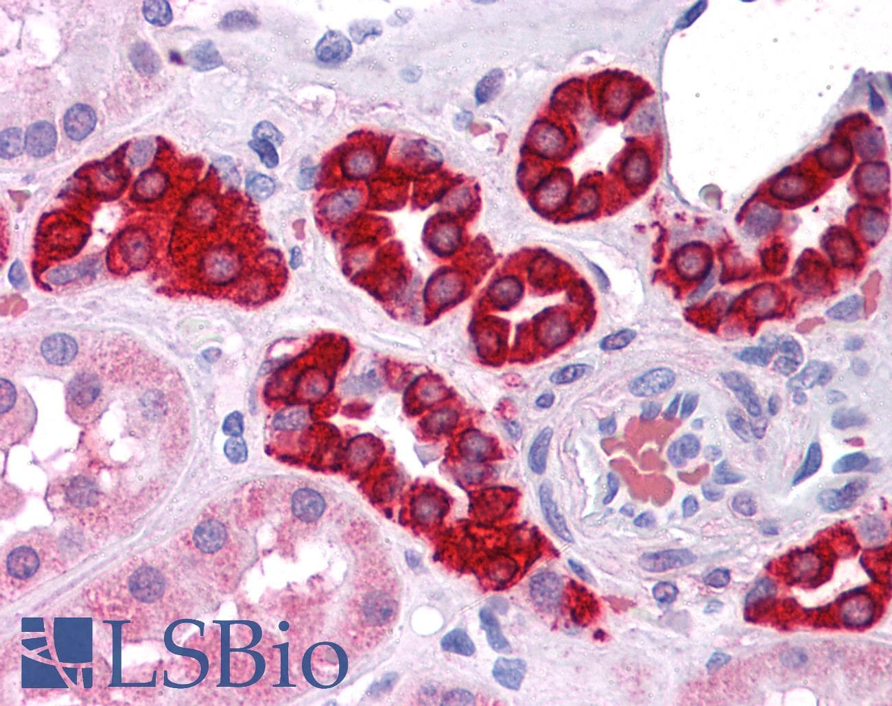 IHC-plus™ AG3 / AGR3 Antibody (clone AGR3.1)
