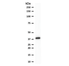 SPI1 / PU.1 Antibody (clone TFPU1-1)