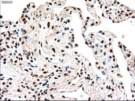 TYRO3 Antibody (clone OTI2C4)