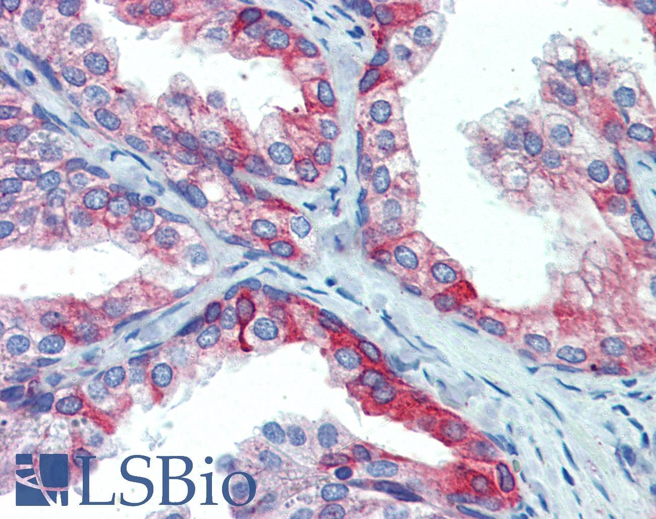 IHC-plus™ PDIA4 / ERP72 Antibody (aa623-638)