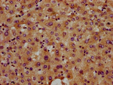 Polyclonal Rabbit anti-Human SNED1 Antibody (IHC)