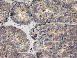 HRAS / H-Ras Antibody (clone OTI1C2)