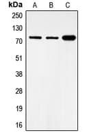 FOXO1 / FKHR Antibody (phospho-Ser319)