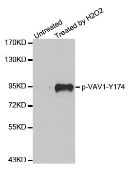 Polyclonal Rabbit anti-Human VAV1 / VAV Antibody (phospho-Tyr174, WB)