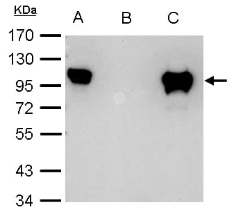 IHC-plus™ Polyclonal Rabbit anti-Human Glucocorticoid Receptor Beta Antibody (N-Terminus, IHC, WB)