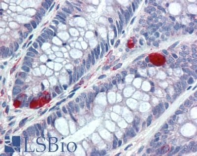ANGPTL8 / Betatrophin Antibody (aa16-198)