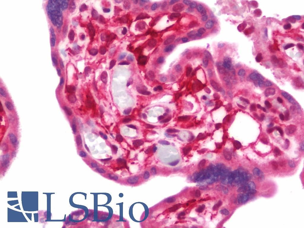 IHC-plus™ Polyclonal Rabbit anti-Human PVRL2 / CD112 Antibody (aa270-499, IHC, WB)