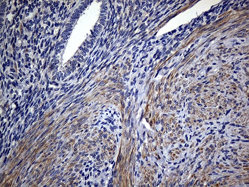 FAM151B Antibody (clone OTI1F5)