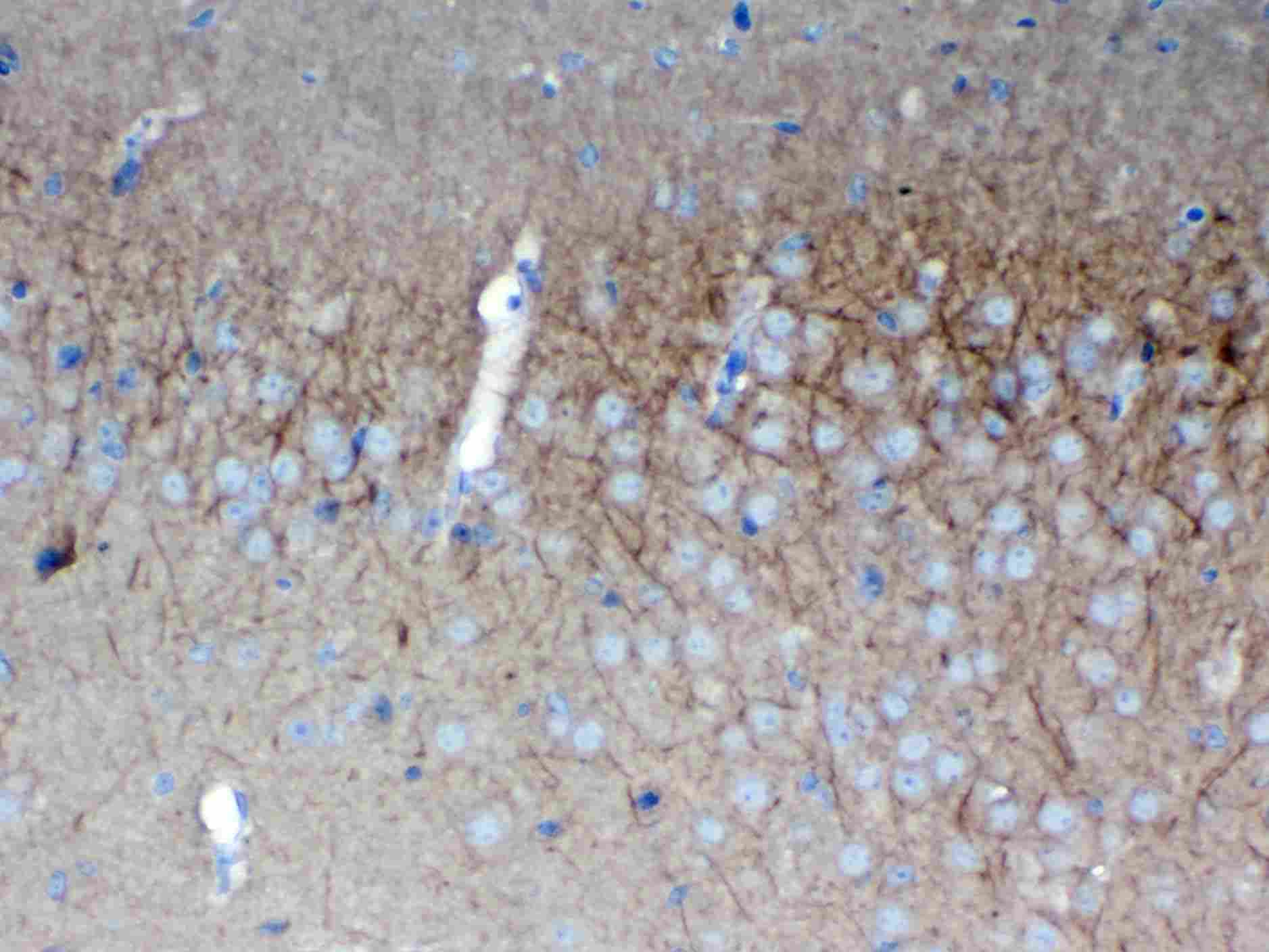 DLG3 / SAP102 Antibody