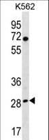 Polyclonal Rabbit anti-Human RPA4 Antibody (aa234-261, WB)