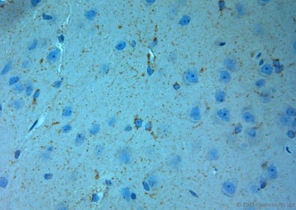 Polyclonal Rabbit anti-Rat GRIN3A / NR3A Antibody (aa1091-1135, IHC)