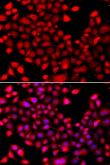 Polyclonal Rabbit anti-Human RARG / RAR-Gamma Antibody (IHC, IF, WB)