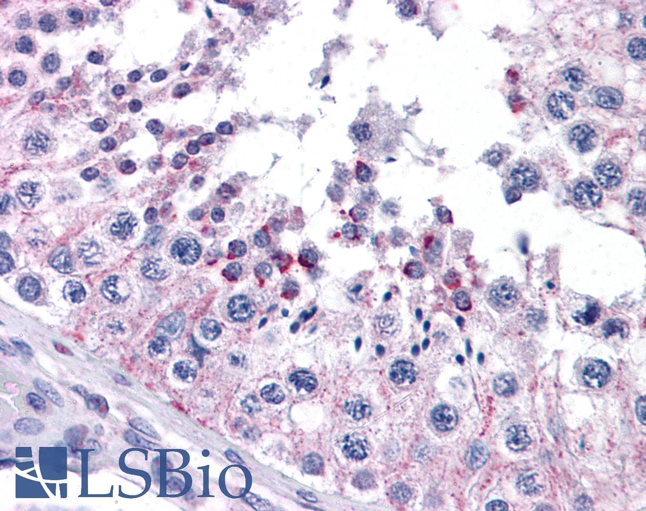 IHC-plus™ FZD9 / Frizzled 9 Antibody (aa579-590)
