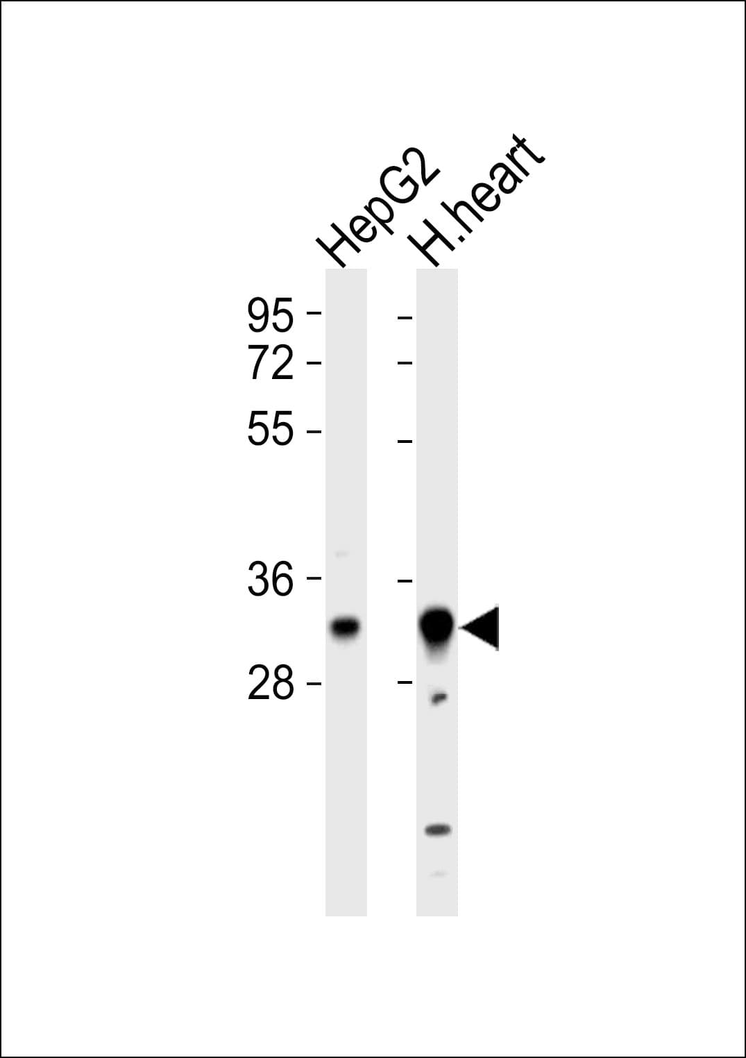 HCCS Antibody
