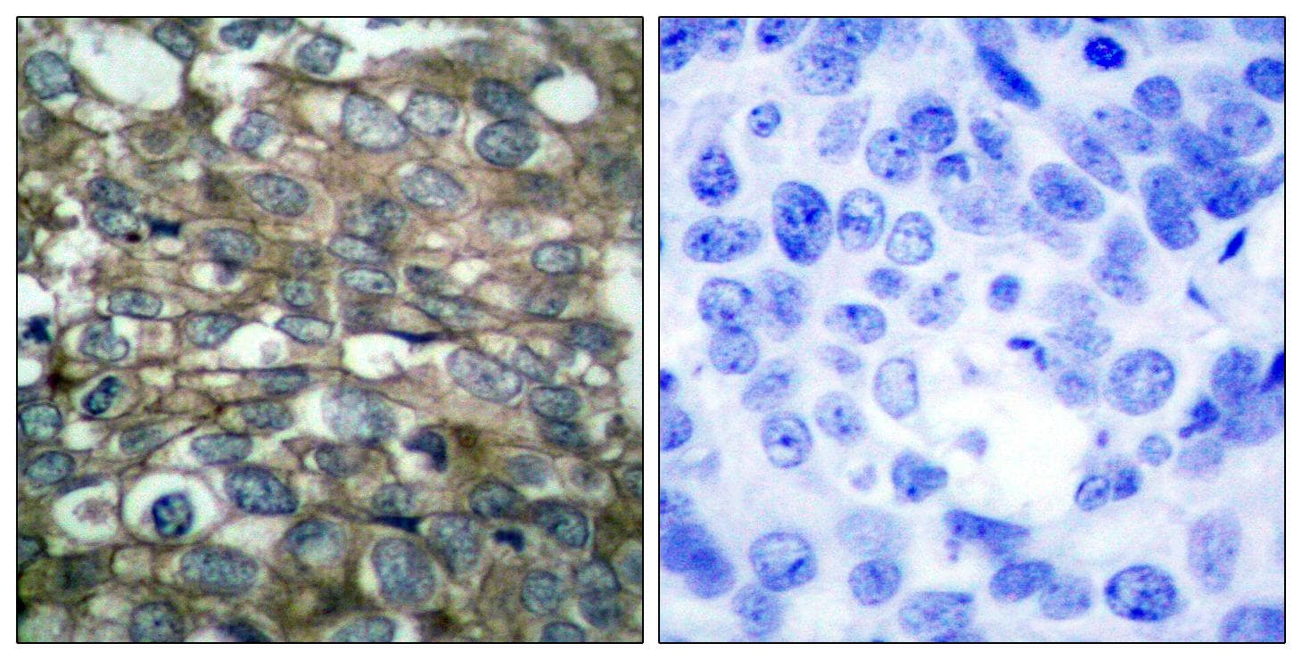 EGFR Antibody (p869)