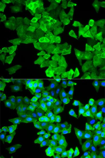 Polyclonal Rabbit anti-Human CALD1 / Caldesmon Antibody (IHC, IF, WB)