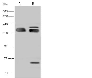 SF3B2 Antibody