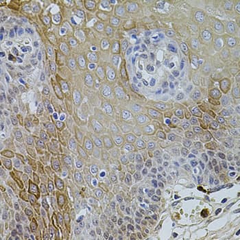 Polyclonal Rabbit anti-Human KCNJ3 / GIRK1 Antibody (IHC, WB)