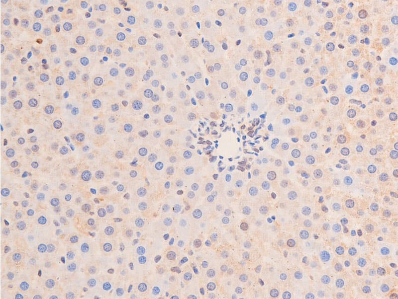 TP53 / p53 Antibody (phospho-Ser15)